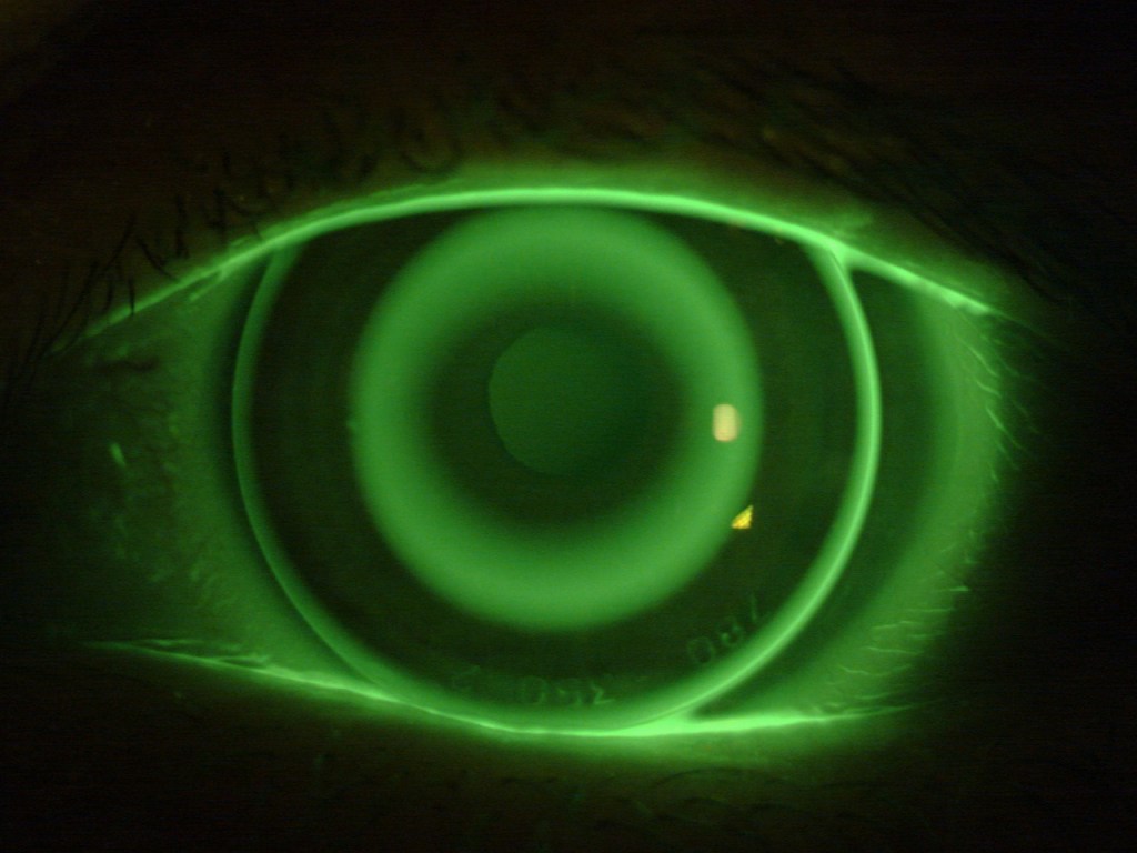 Is the future of military binoculars robotic contact lenses?