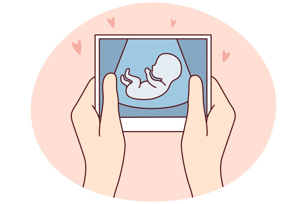 Looking for infertility coverage in FEHB plans? Read the fine print.