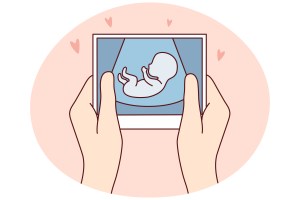 Looking for infertility coverage in FEHB plans? Read the fine print.