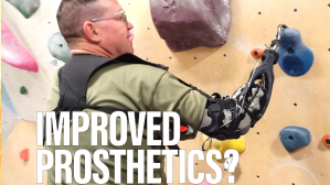 Prosthetics made from running shoes? Meet “Stumpworx”
