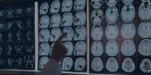Traumatic brain injury signs can show up years later – but it’s not too late to seek care